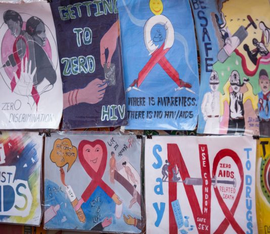 history of aids